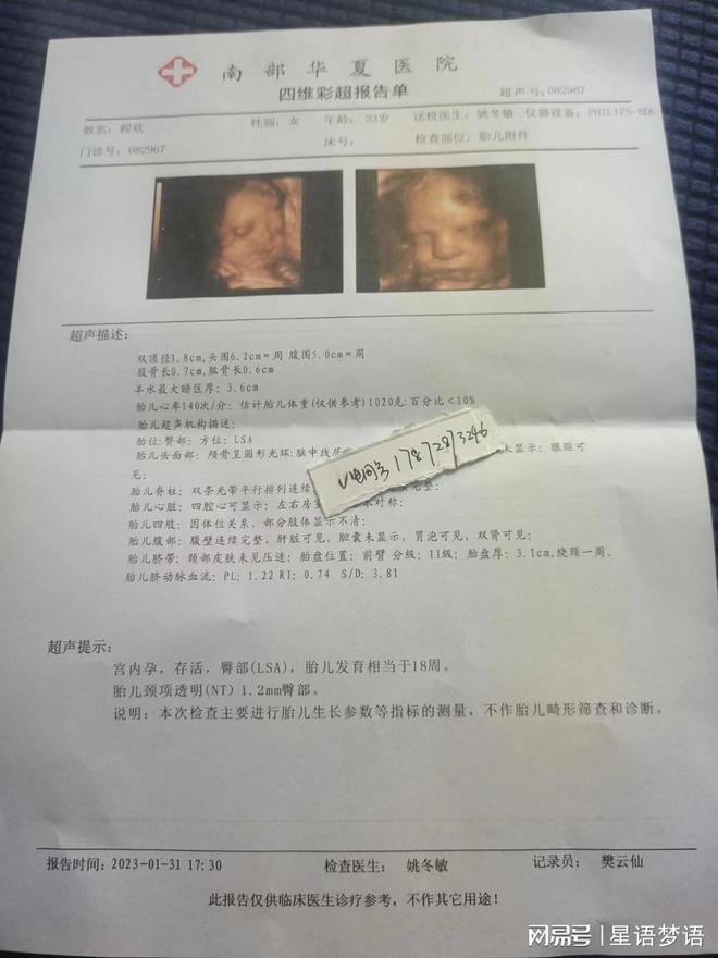 上海最新病例，疾病防控与医疗进步的展示窗口