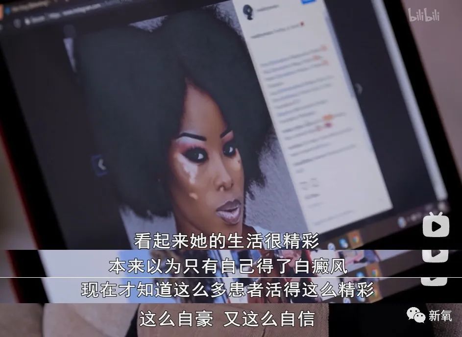 白癜风演员的心灵之旅，与自然美景的轻松对话，探寻内心宁静之路