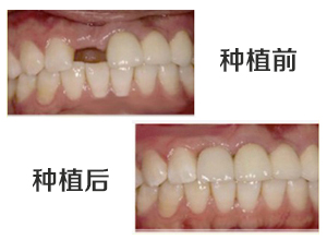 最新牙齿修复技术揭秘,小巷中的隐秘宝藏牙科诊所