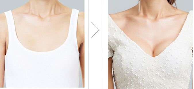 丰胸价格揭秘,历史背景与现代洞察