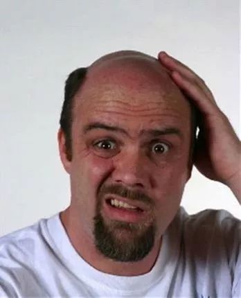 秃顶男潮流指南,最新流行趋势解析